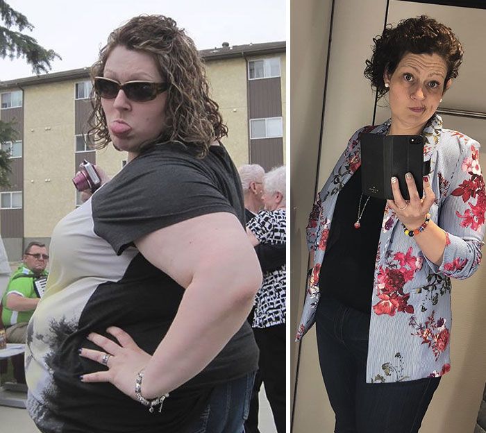 A Woman Lost 150 Pounds (68 kg) (12 pics)