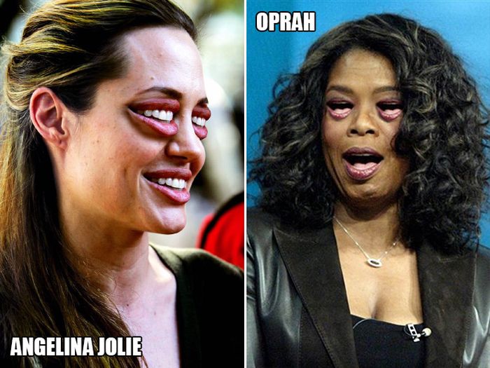 Celebrities With Mouth Eyes (18 pics)