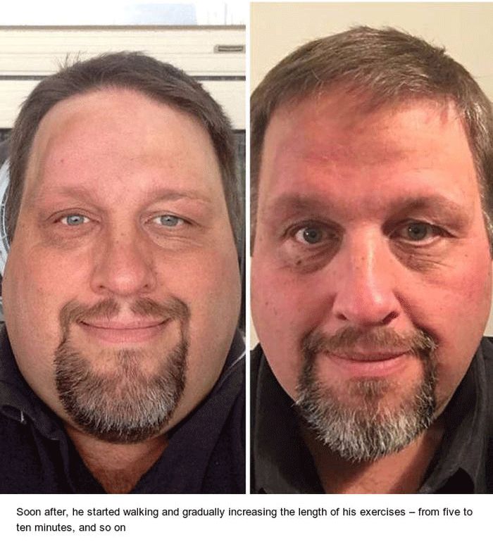 This Guy Has Lost A Lot Of Weight (13 pics)