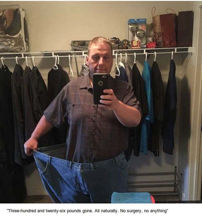 This Guy Has Lost A Lot Of Weight (13 pics)