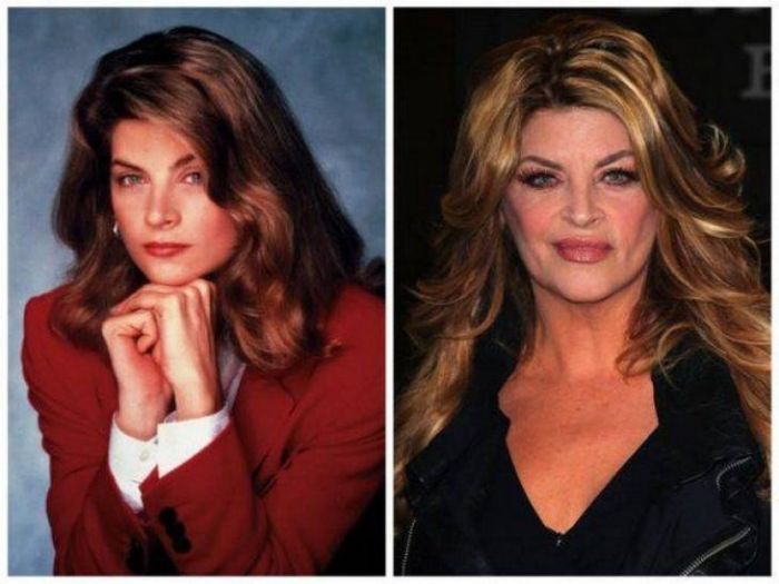 Celebs Then And Now (15 pics)