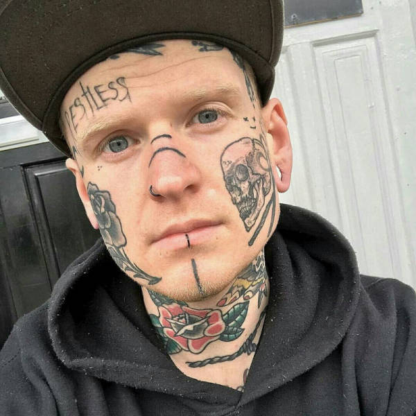 People Just Won’t Stop Mutilating Themselves (39 pics)