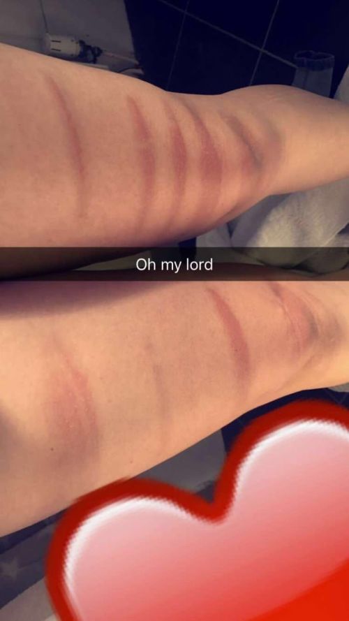 Ripped Jeans In The Sun Are Very Bad For Your Skin (18 pics)