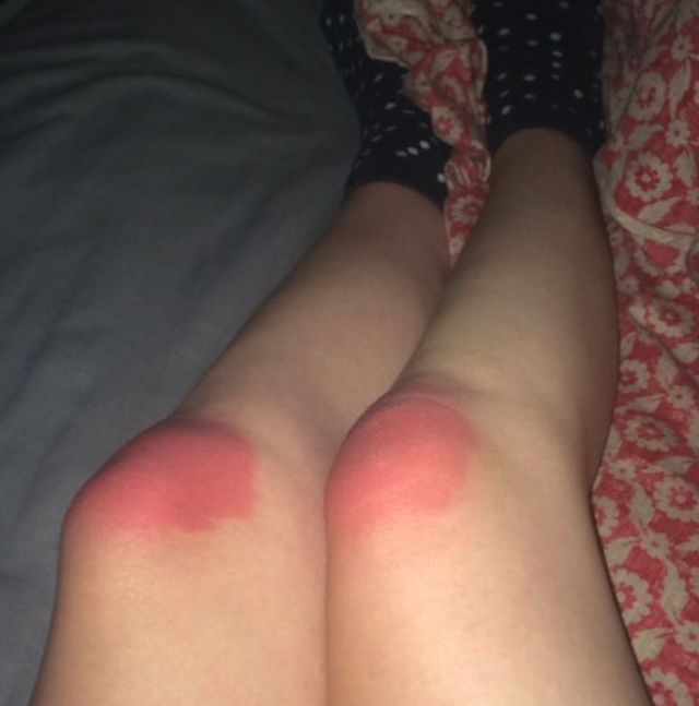 Ripped Jeans In The Sun Are Very Bad For Your Skin (18 pics)