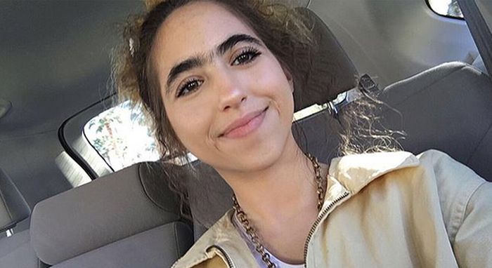 Girls With Unibrows (16 pics)