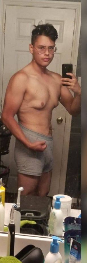 This Guy Has Lost A Lot Of Weight (4 pics)