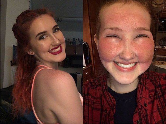 When Allergy Strikes (19 pics)