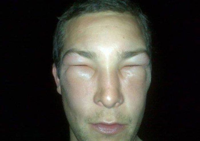 When Allergy Strikes (19 pics)