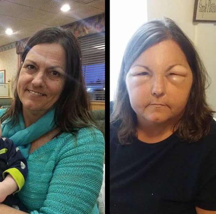 When Allergy Strikes (19 pics)