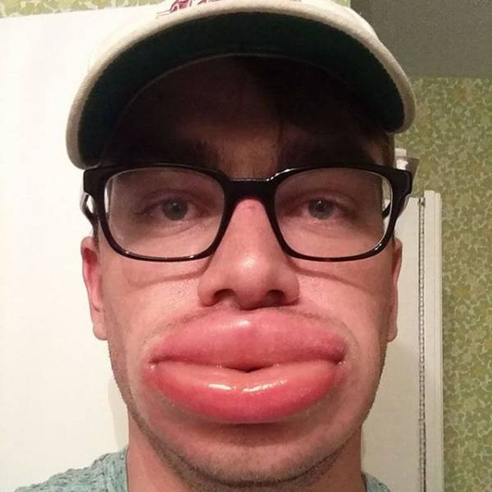 When Allergy Strikes (19 pics)