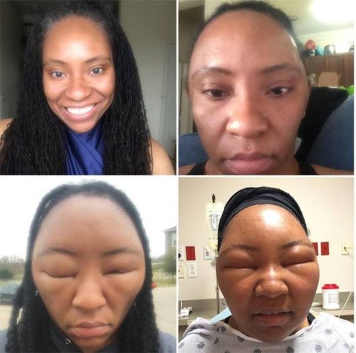 When Allergy Strikes (19 pics)