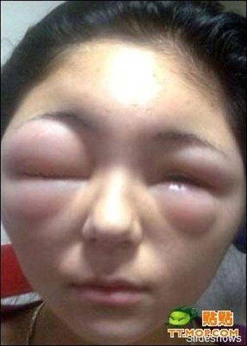 When Allergy Strikes (19 pics)