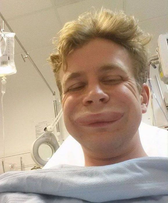 When Allergy Strikes (19 pics)