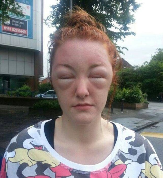 When Allergy Strikes (19 pics)