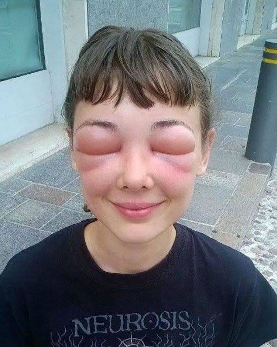 When Allergy Strikes (19 pics)