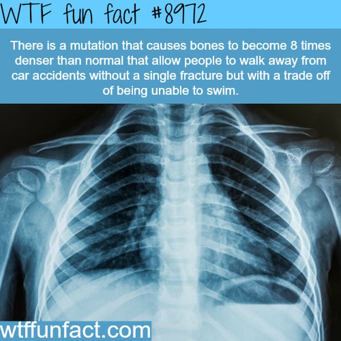 WTF Fun Facts (25 pics)