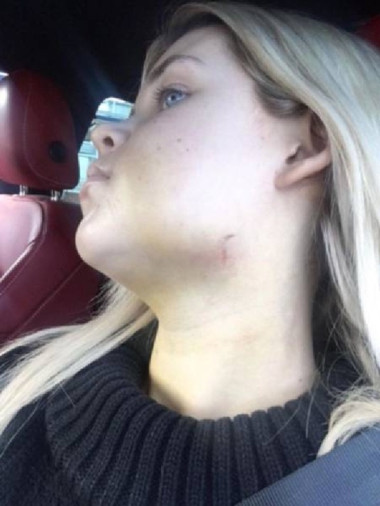 Girl Before And After Face Plastic Surgery (13 pics)