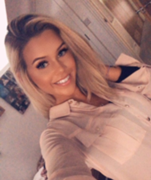 Girl Before And After Face Plastic Surgery (13 pics)