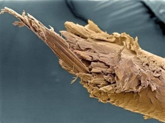 Our Body Through A Microscope (16 pics)