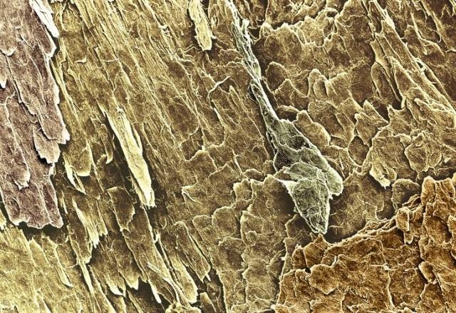 Our Body Through A Microscope (16 pics)