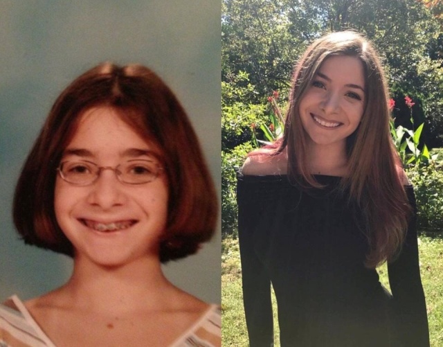 From Ugly Duckling To Beautiful Swan (17 pics)