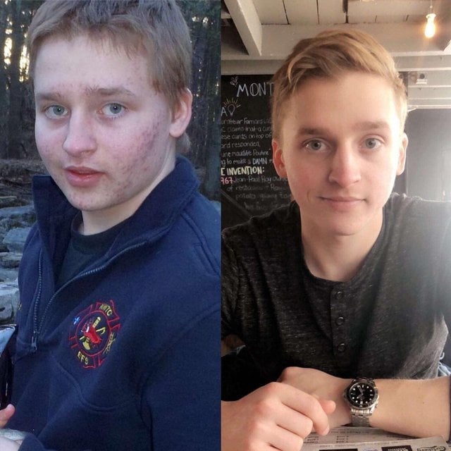 From Ugly Duckling To Beautiful Swan (17 pics)