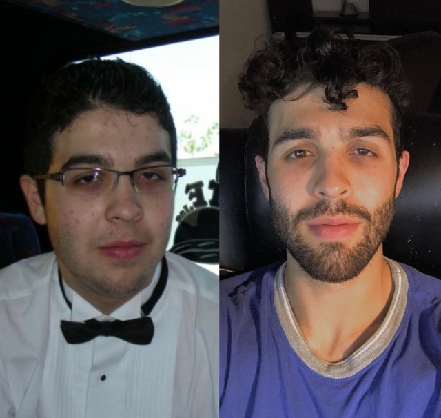 From Ugly Duckling To Beautiful Swan (17 pics)