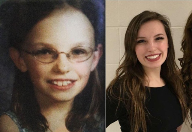 From Ugly Duckling To Beautiful Swan (17 pics)