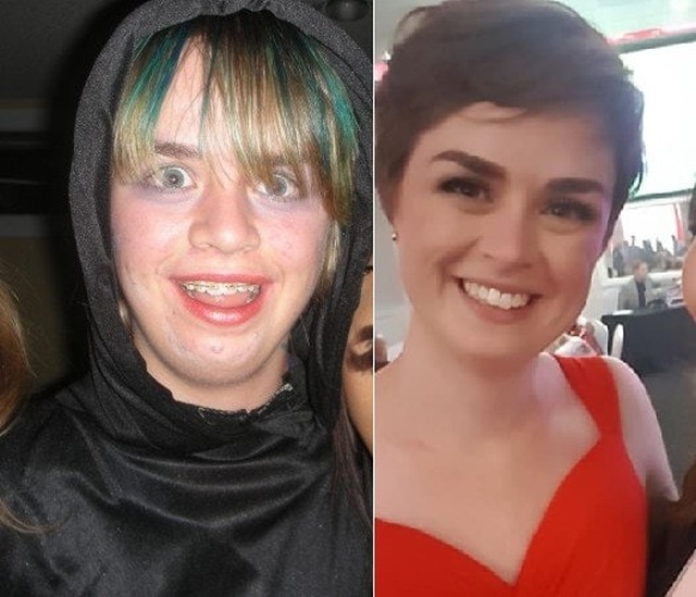 From Ugly Duckling To Beautiful Swan (17 pics)