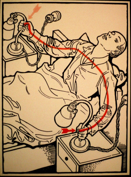 There Were Hundreds Of Ways To Get Electrocuted In The Beginning Of The 20th Century (29 pics)