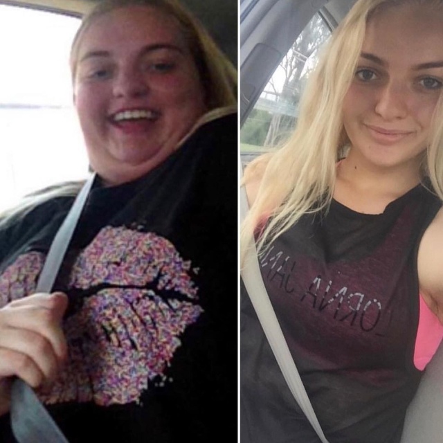 Schoolgirl Lost 140 lbs (64 kg) (7 pics)