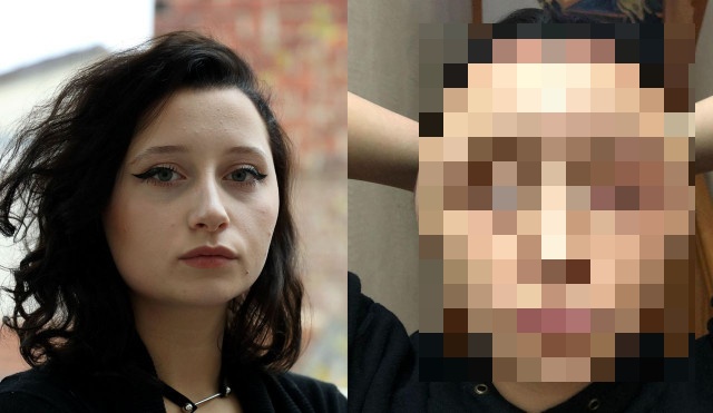 Lady’s Head Expands After Using Hair Dye (9 pics)