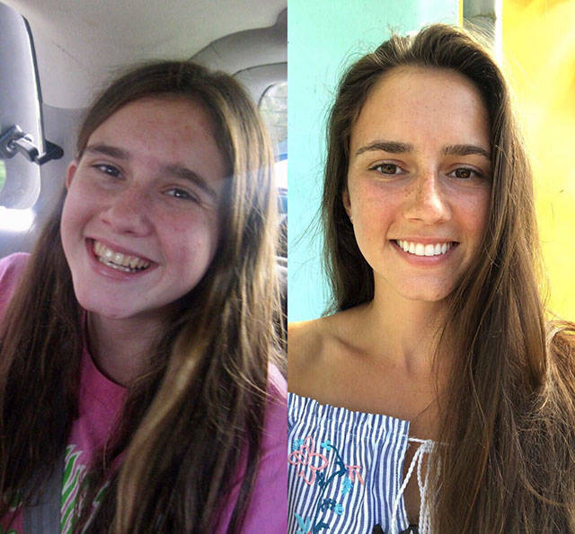 They Used To Be Ugly Ducklings (23 pics)