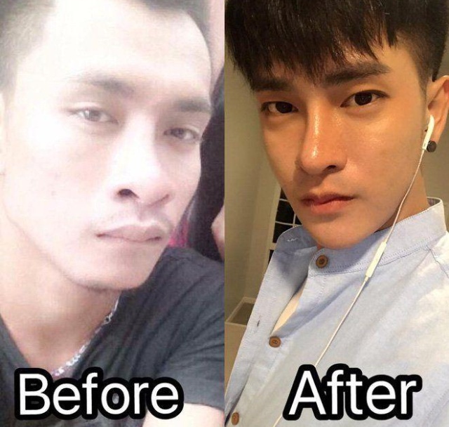 Thai Man Undergoes 30 Cosmetic Procedures to Make Himself Look Korean (5 pics)