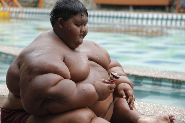 Indonesia’s Fattest Kid Lost Half His Body Weight (9 pics)