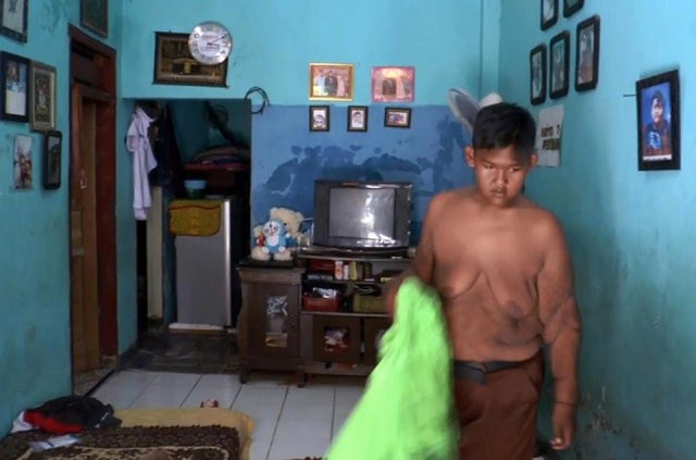 Indonesia’s Fattest Kid Lost Half His Body Weight (9 pics)