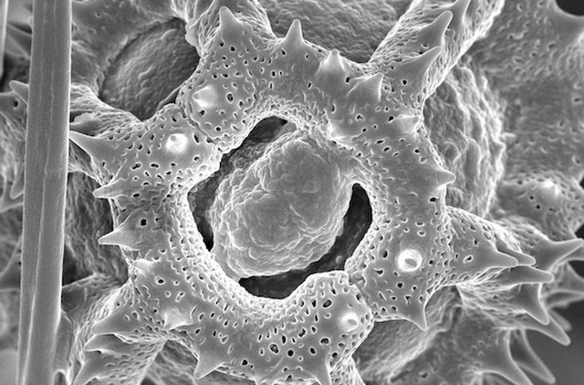 Pollen On A Bee, Seen Through A Powerful Microscope (3 pics)