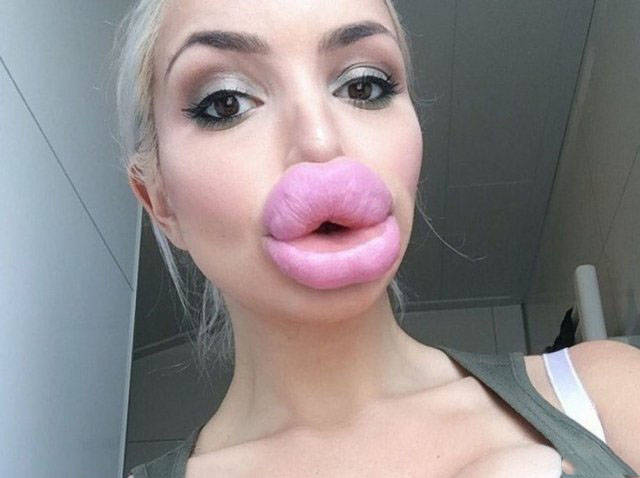 Fat Lips (33 pics)