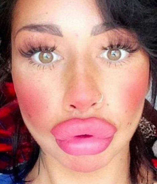 Fat Lips (33 pics)