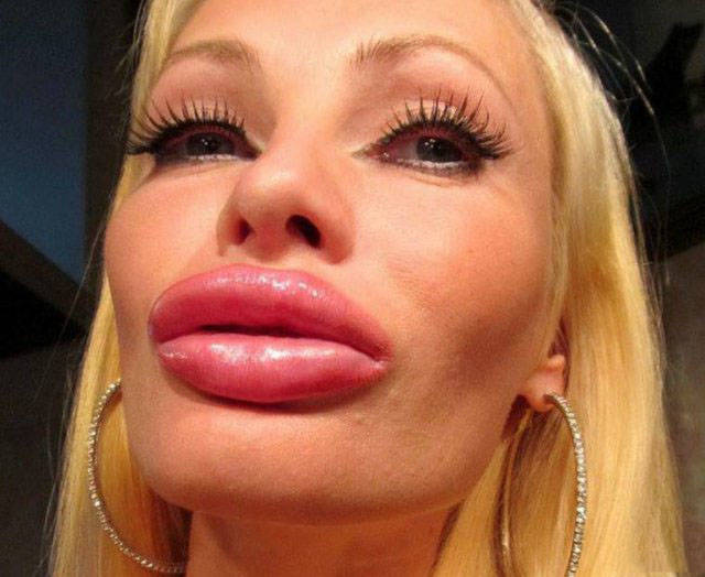 Fat Lips (33 pics)