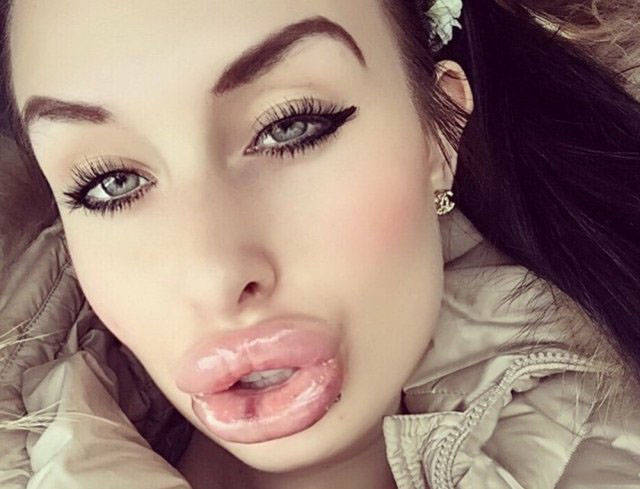 Fat Lips (33 pics)