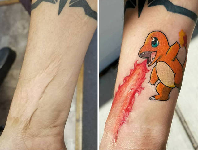 How To Cover A Scar With Tattoo (41 pics)