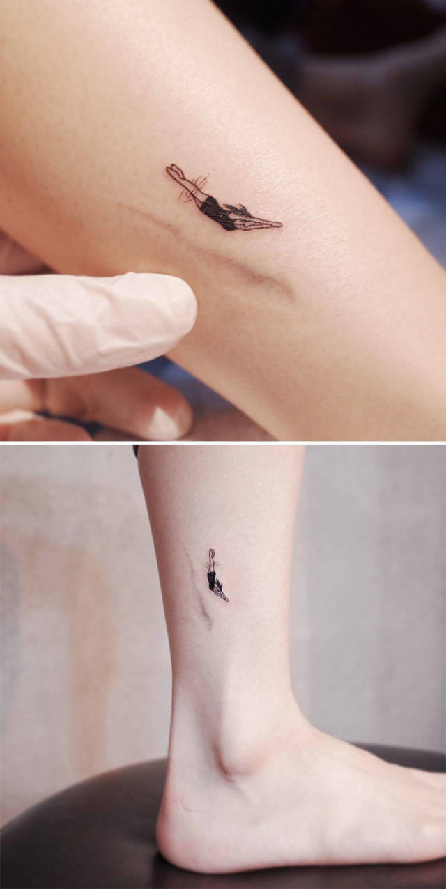 How To Cover A Scar With Tattoo (41 pics)