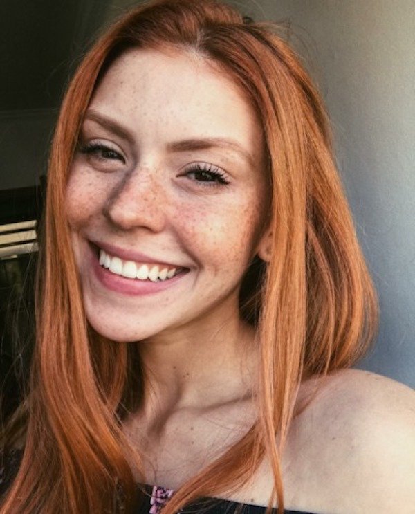 Girls With Freckles (27 pics)