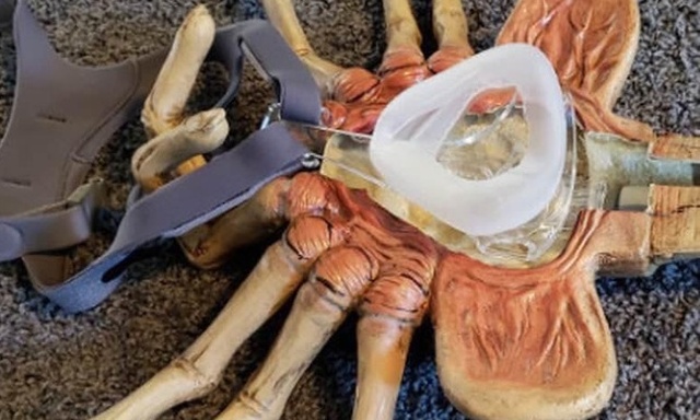 The Most Creative Sleep Apnea Mask (2 pics)