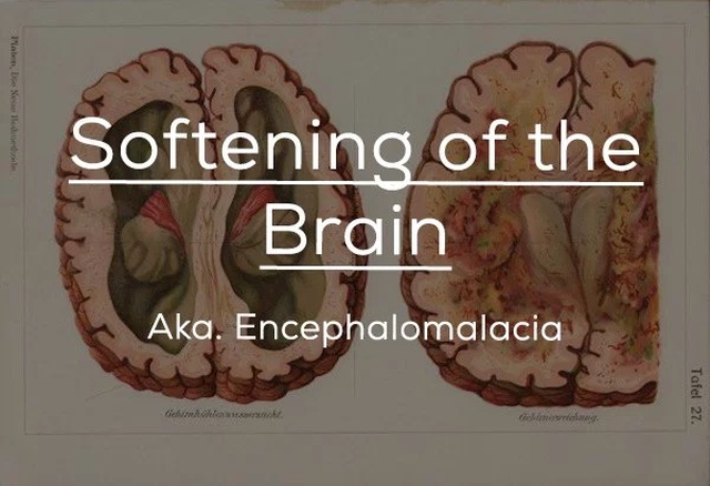 Old-fashioned Medical Terms (24 pics)