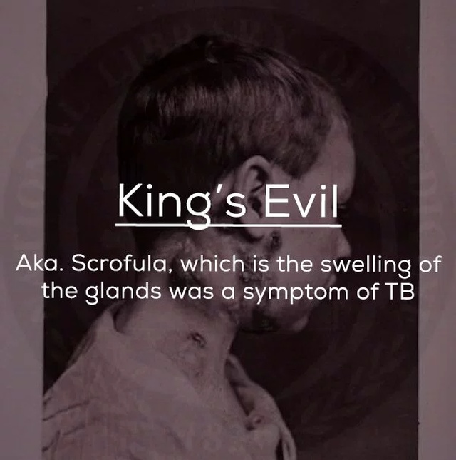 Old-fashioned Medical Terms (24 pics)