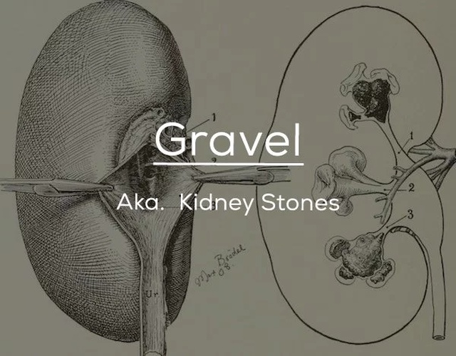 Old-fashioned Medical Terms (24 pics)