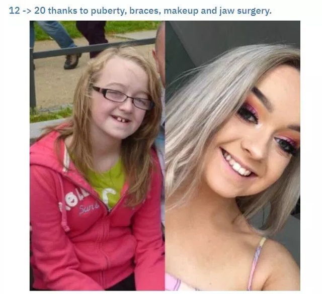 Teenager Transformations (23 pics)