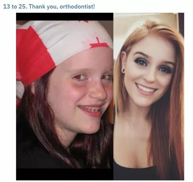 Teenager Transformations (23 pics)